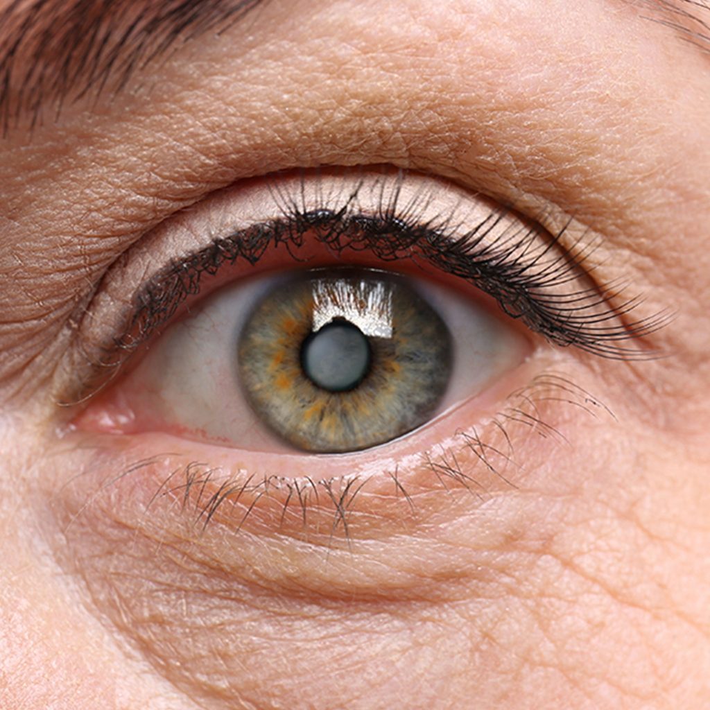 Esthetrip-OPHTALMOLOGIE