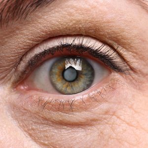 Esthetrip-OPHTALMOLOGIE