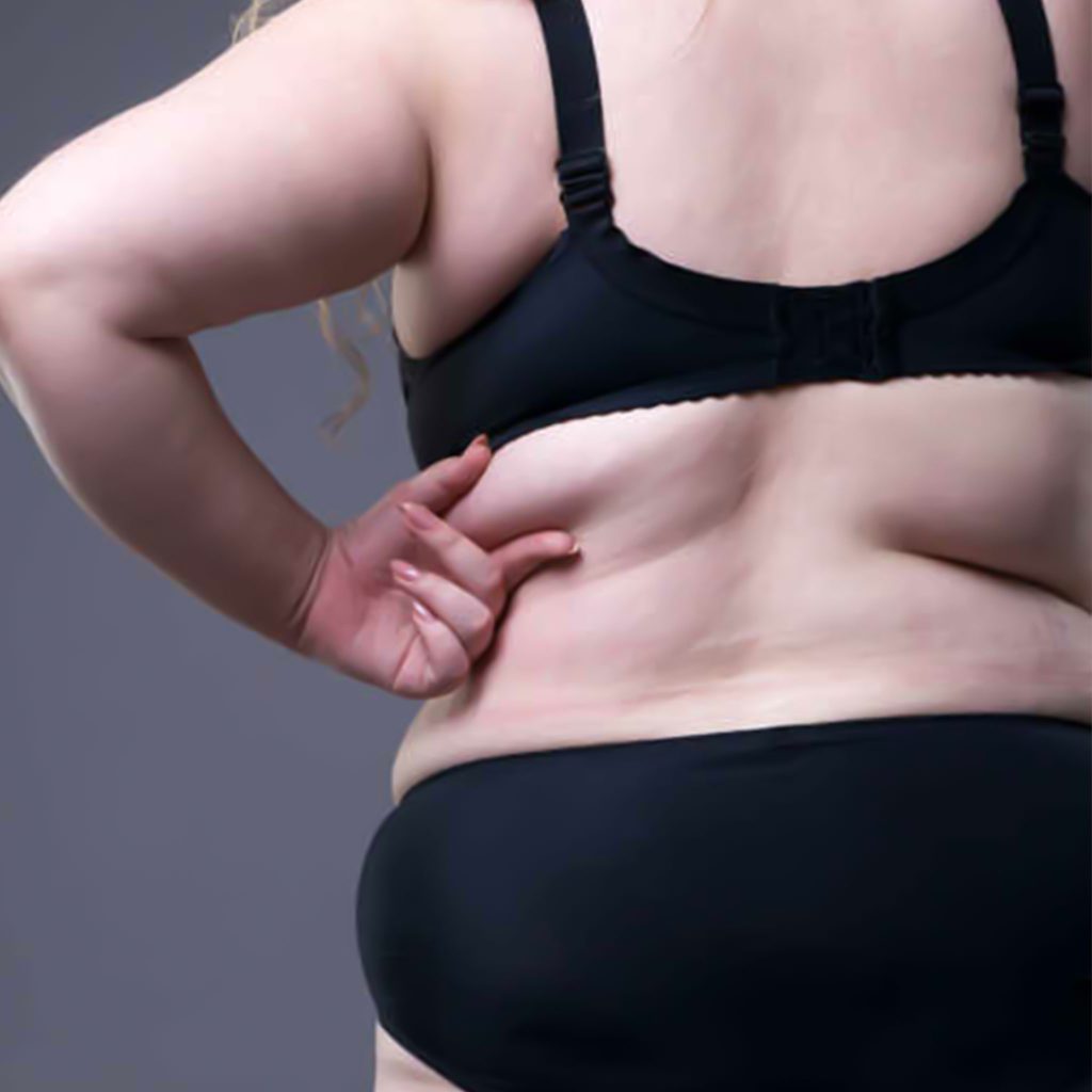 Esthetrip-Traitement-de-l'obésité